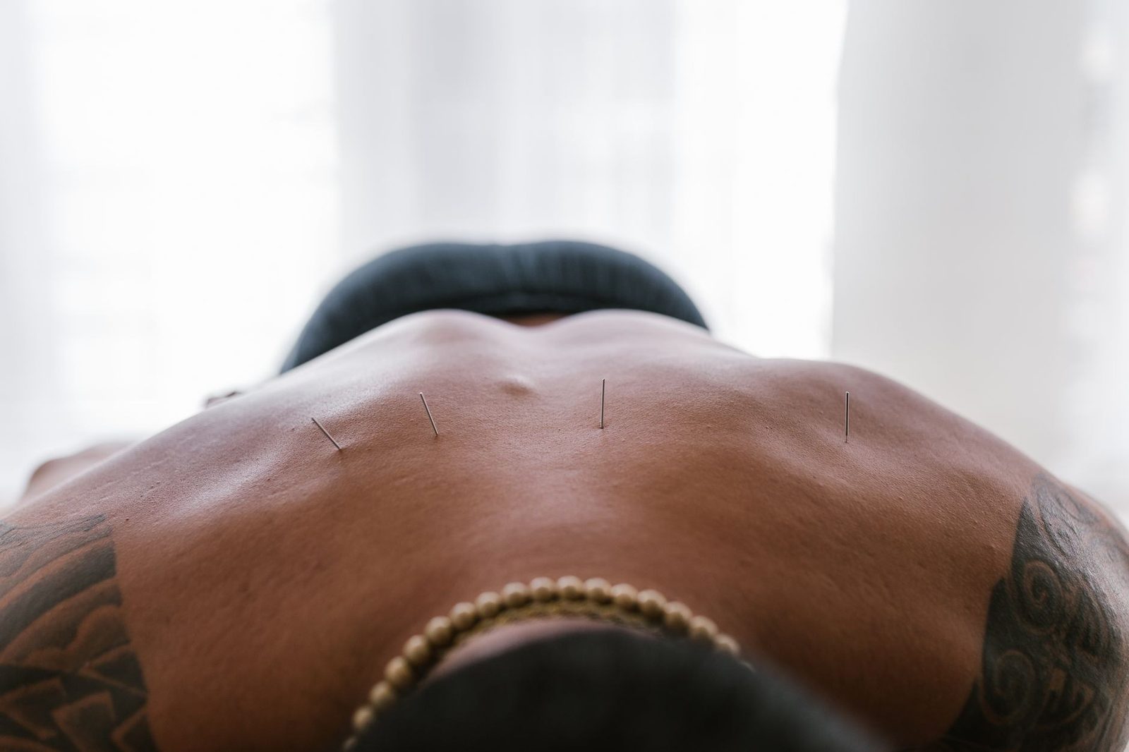 What to expect at your first acupuncture session