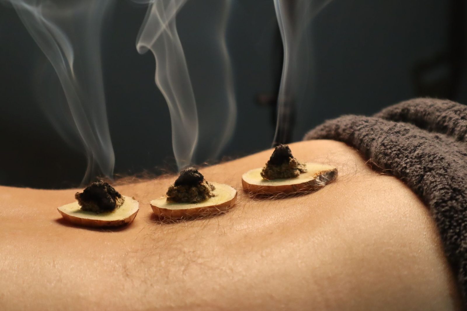 How acupuncture helps with stress and sleep